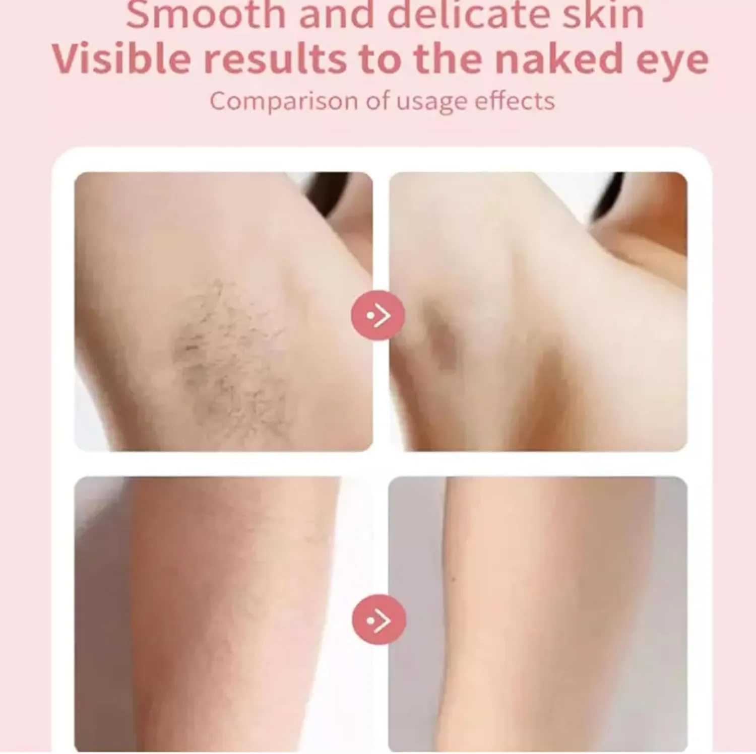 Pluzy Epil Pro 3.0 Women's Face Epilator, Hair Removal for Face, Legs, Underarms (Battery Type)