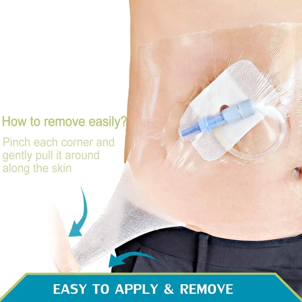 Tattoo Aftercare Bandage 6x6 inch Second Skin Healing Protective Clear Adhesive Film Dressing Supplies Cover for Large Port Surgery Incisions Guard Bath Wounds Patch (Pack of 50)